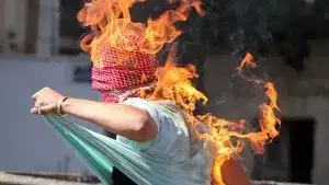 Palestinian_burns_own_head